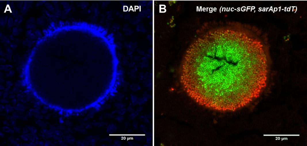 host-pathogen interaction