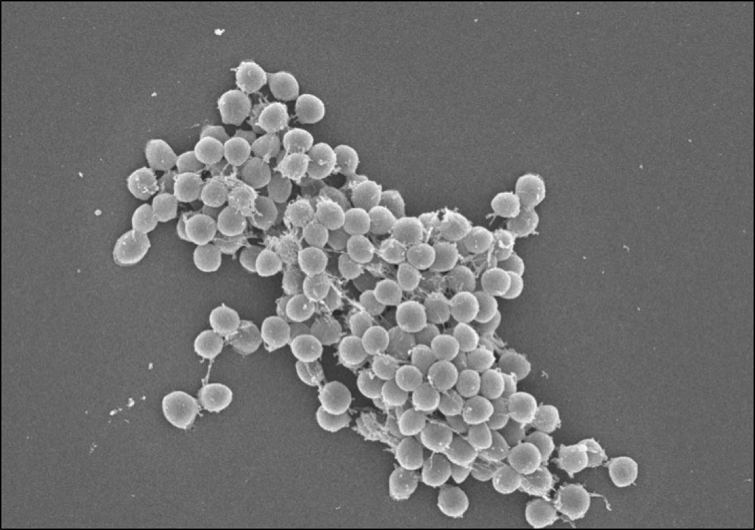 biofilm